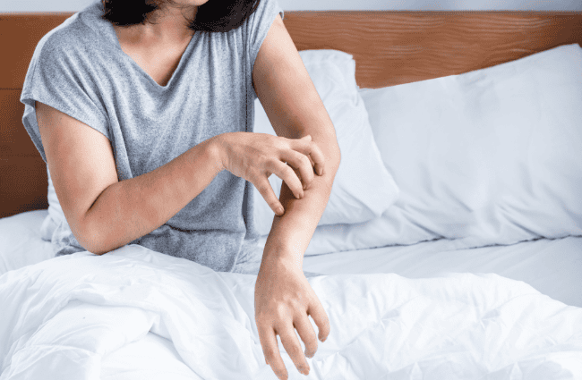 a woman scratching bed bug bites